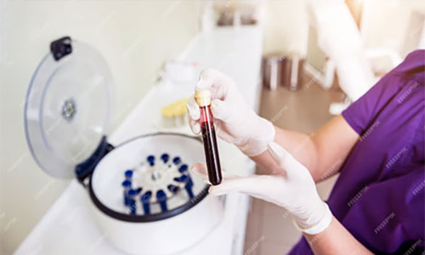 Плазмоліфтинг